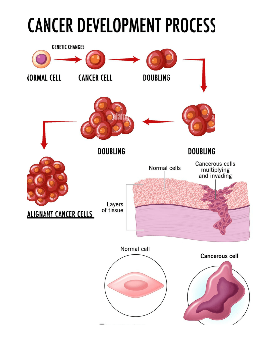 Cancer Development